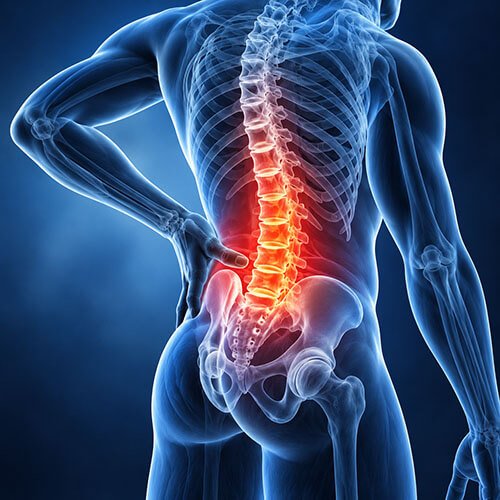 sciatica →